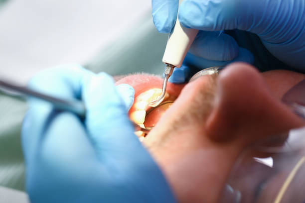 Best Emergency Dental Care for Broken or Chipped Teeth in Rutherfordton, NC
